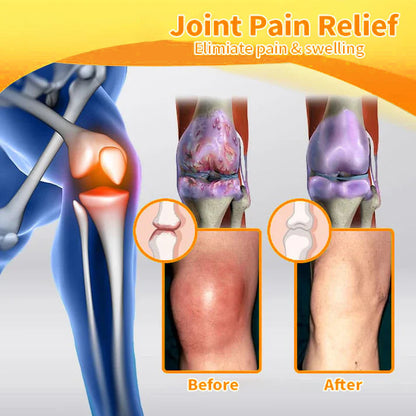 Fivfivgo™ Bee Venom and Turmeric Joint and Bone Pain Relief Spray (Specialized in Joint and Arthritis Pain & Recommended by AAOS)