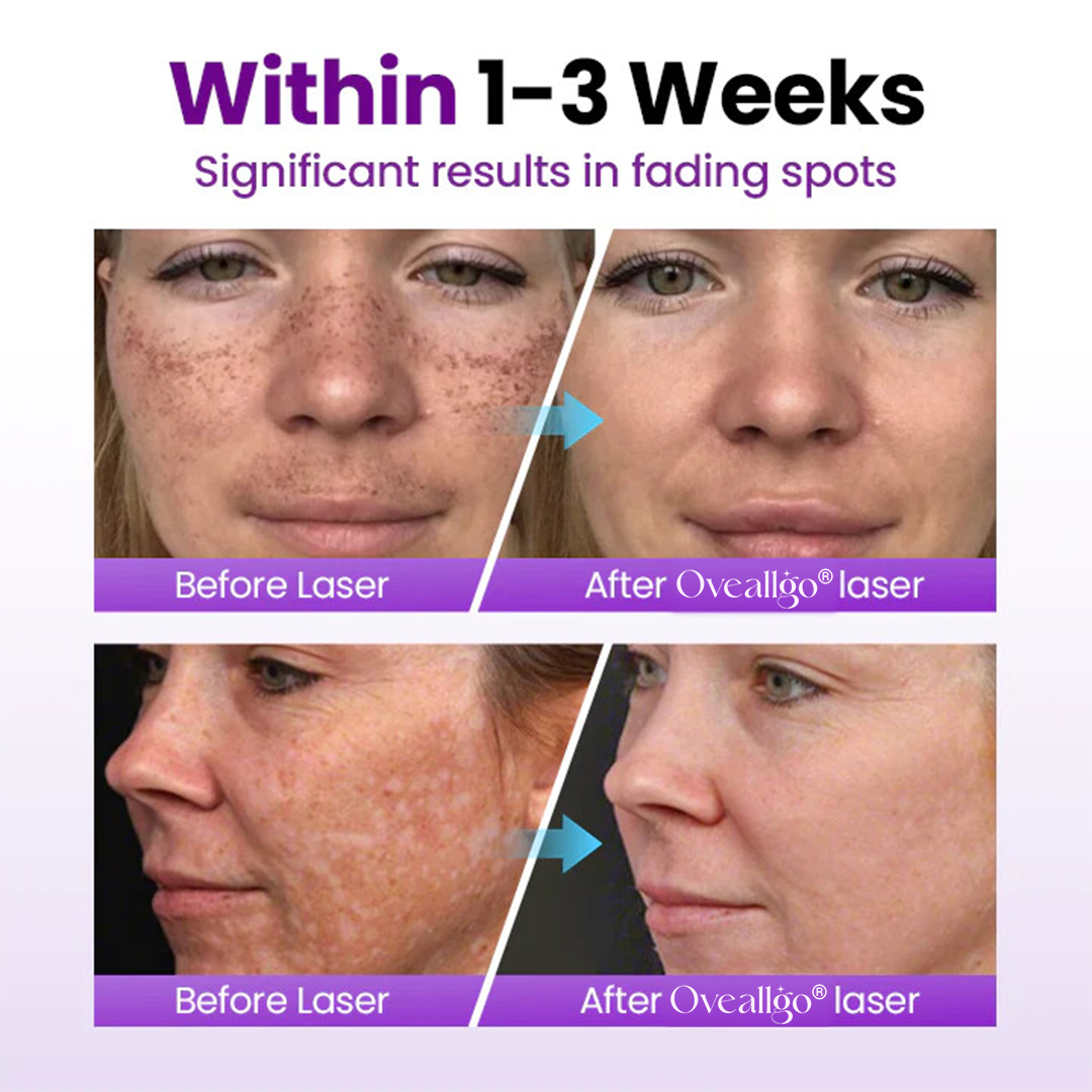 Oveallgo® SpotErase Probiotic Shield Serum