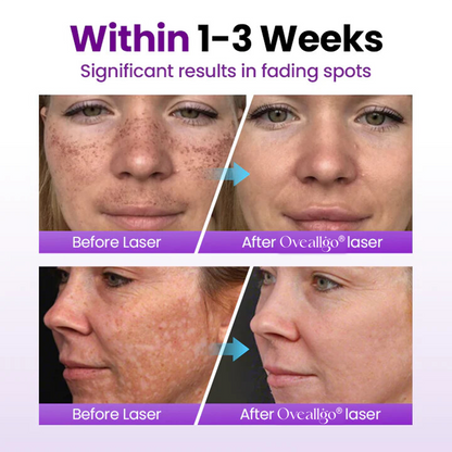 Oveallgo® SpotErase Probiotic Shield Serum