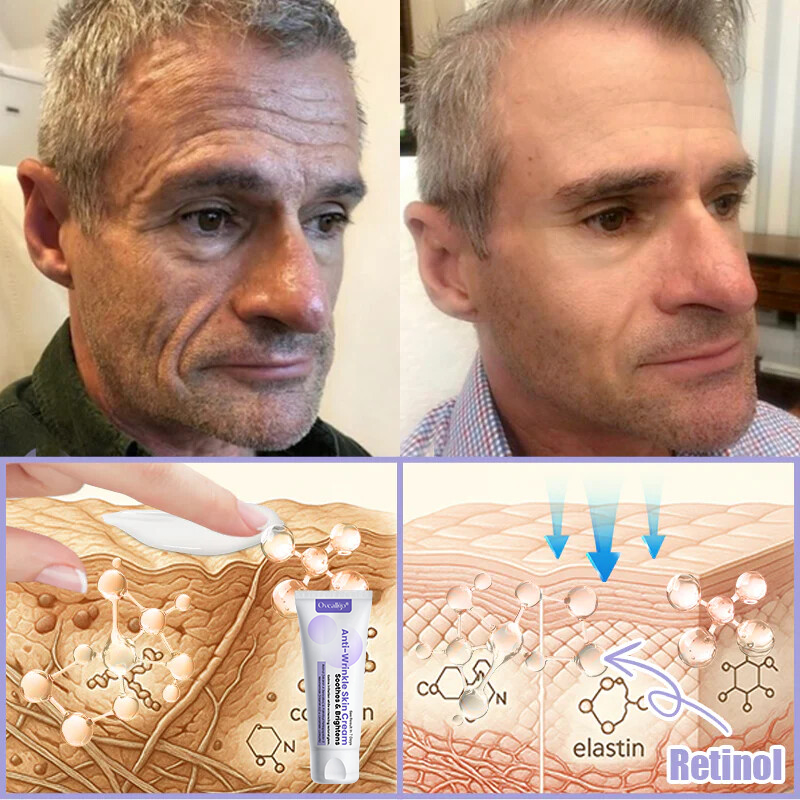 Oveallgo® Anti-Wrinkle Cream To Eliminate Wrinkles, Firm And Whiten The Skin - Last offer! 🔥90% discount