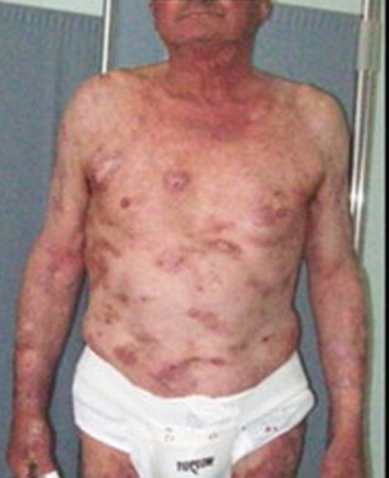 Oveallgo® Shingles Calm Snake Peptide Ampoules 25 Oveallgo® Shingles Calm Snake Peptide Ampoules