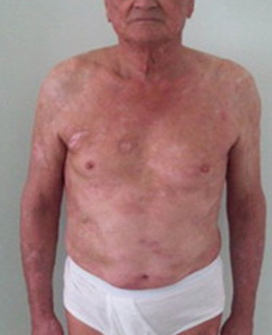 Oveallgo® Shingles Calm Snake Peptide Ampoules 27 Oveallgo® Shingles Calm Snake Peptide Ampoules