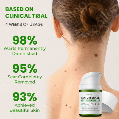 ✅ Official Store: Oveallgo™ NatureErase Instant Mole & Spot Cream
