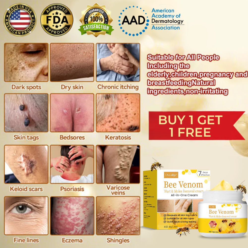 ✅Official Store Oveallgo™ Bee Venom Comprehensive Cream: Anti-aging, Hydrating, Skin Repair, Even Tone, Acne and Dark Spot Treatment, Wartand Mole Removal, PsoriasisRelief. (FDA Approved)