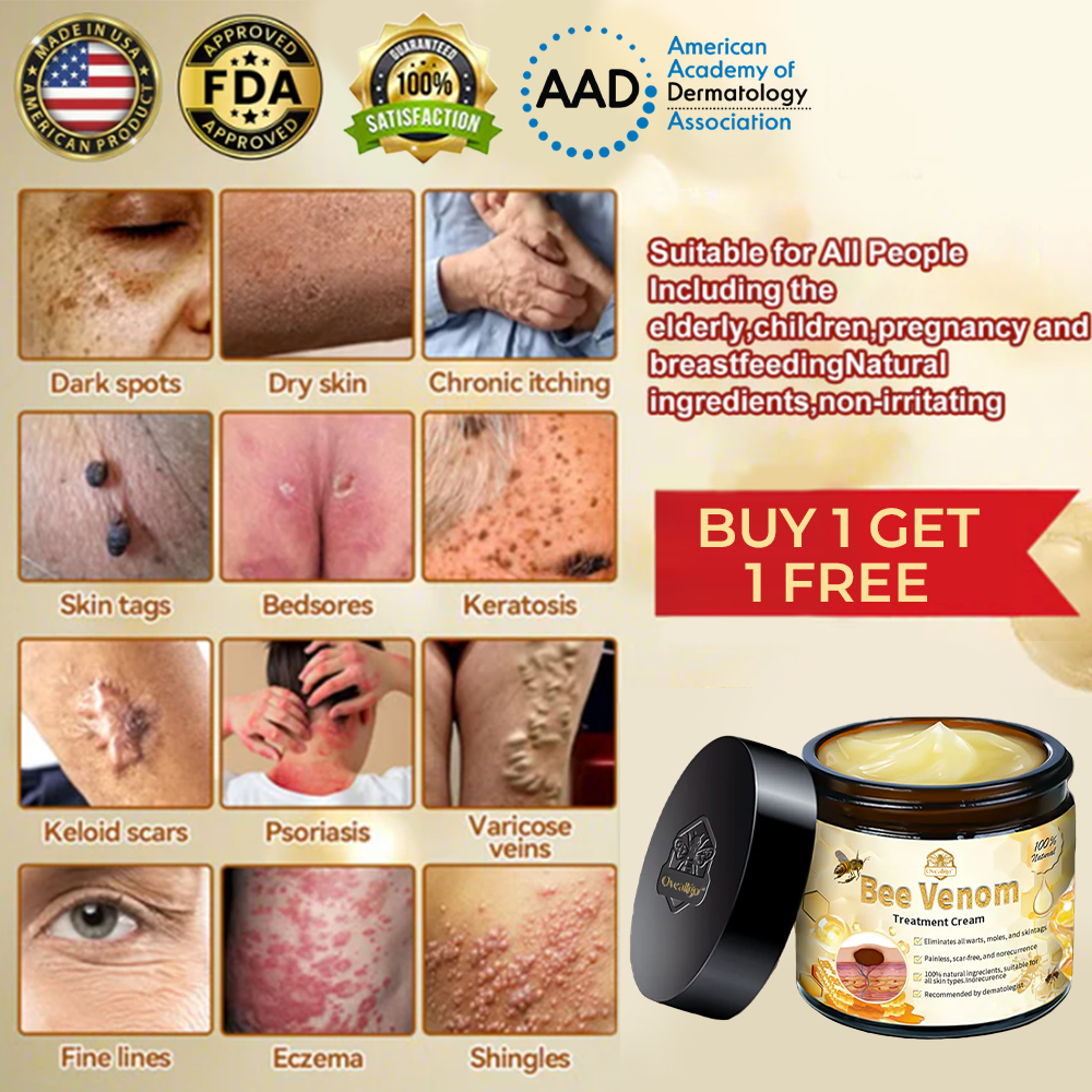 ✅Official Store: Oveallgo™ Bee Venom Skin Treatment Cream (𝐴𝐴𝐷 𝑅𝑒𝑐𝑜𝑚𝑚𝑒𝑛𝑑𝑒𝑑) ✨Anti-aging, Hydrating, Skin Repair, Even Tone, Acne and Dark Spot Treatment, Wartand Mole Removal, PsoriasisRelief