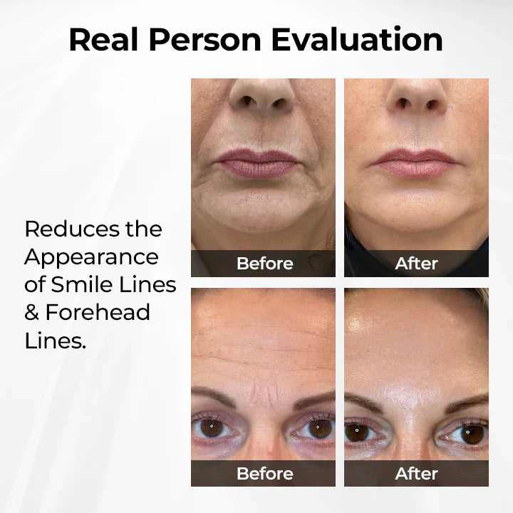 Oveallgo® TightShift Precision Contour & Firming Serum