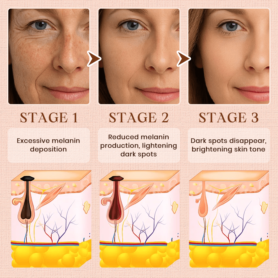 Oveallgo® Purifying Exfoliating Gel for Acanthosis Nigricans, Exfoliation, Dark Spots, Skin Tags, and Eczema_Ultra01