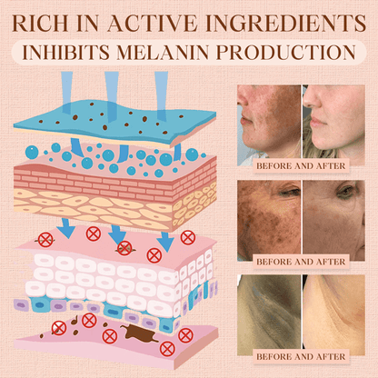 Oveallgo® Purifying Exfoliating Gel for Acanthosis Nigricans, Exfoliation, Dark Spots, Skin Tags, and Eczema_Ultra01
