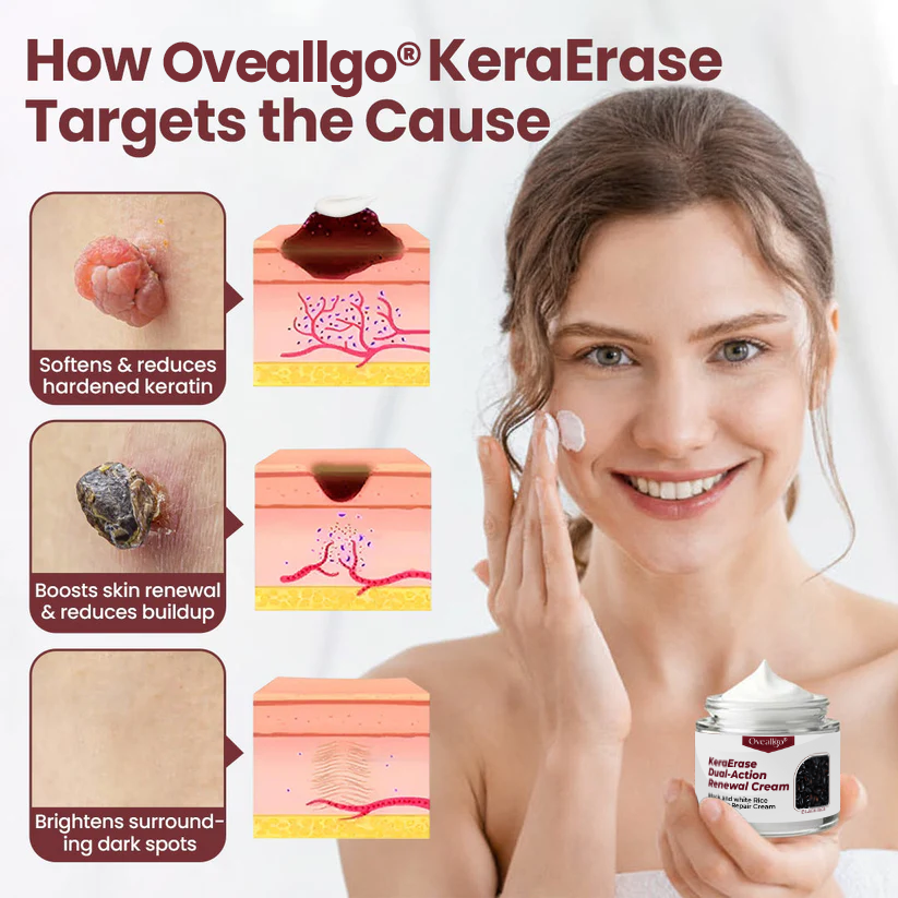 Oveallgo® KeraErase Dual-Action Renewal Cream