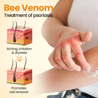 Oveallgo® BeeVenom Soothe Psoriasis Relief Cream