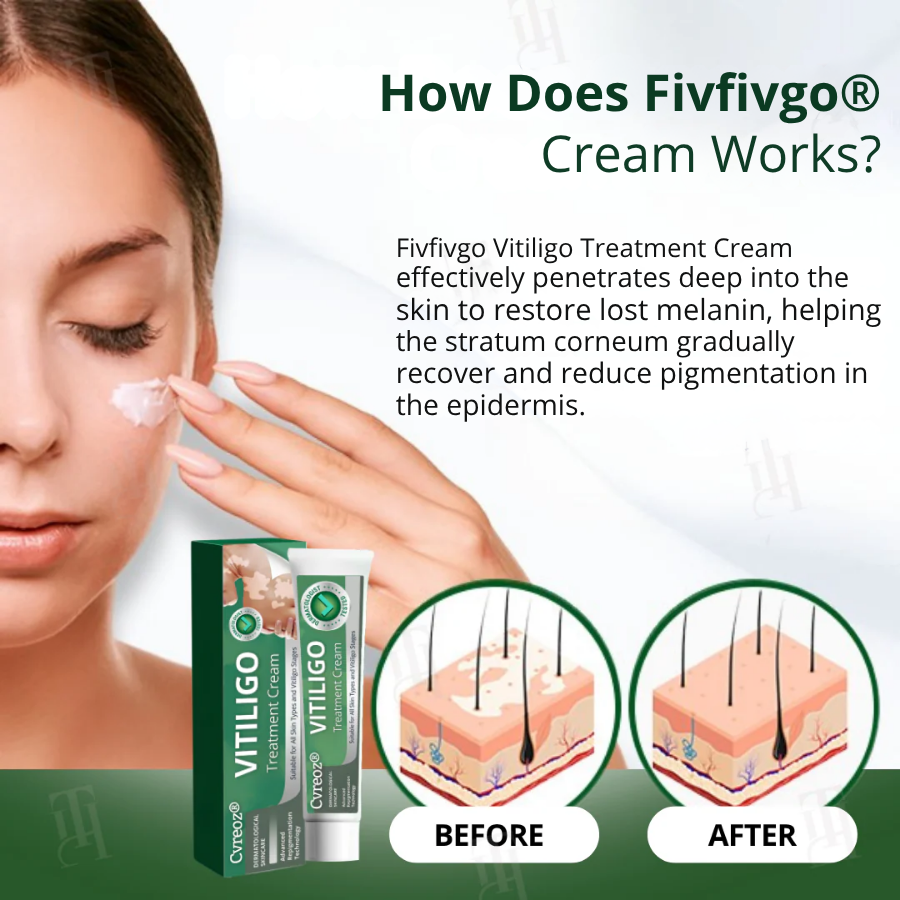 Fivfivgo® Vitiligo Treatment Cream