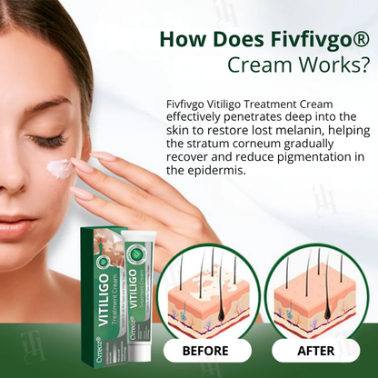 Fivfivgo® Vitiligo Treatment Cream