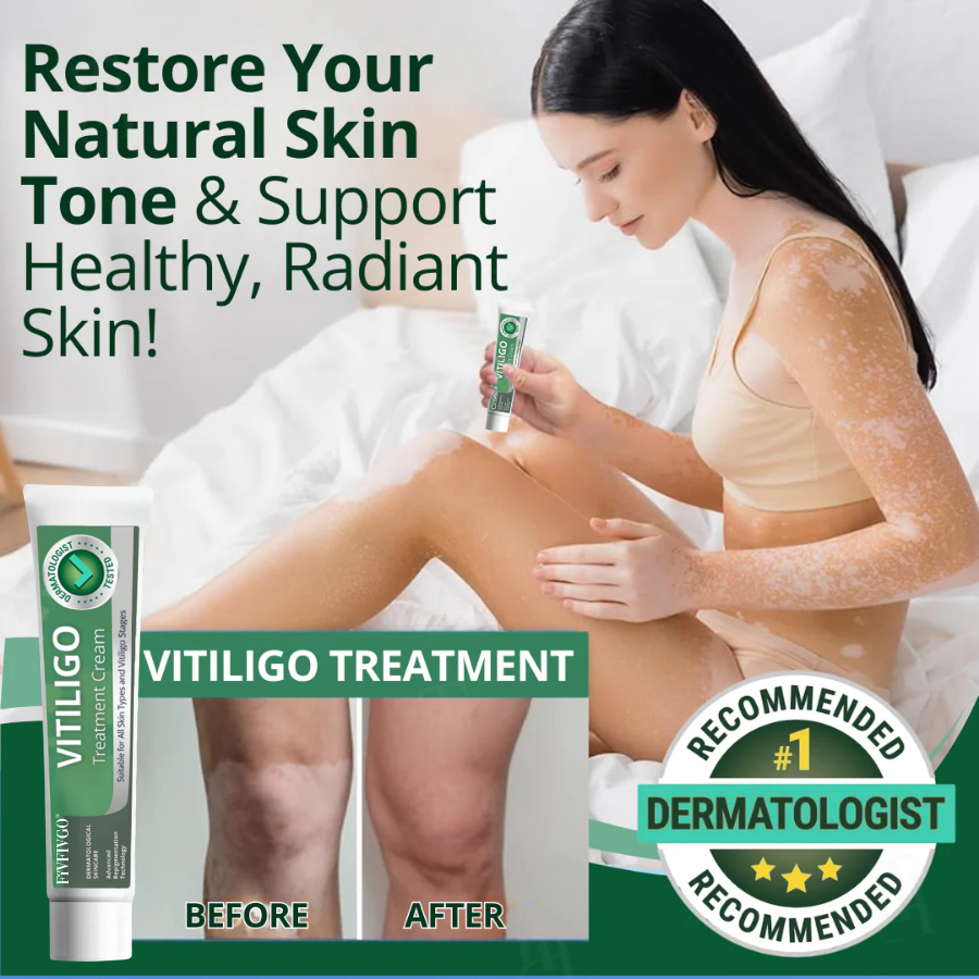 Fivfivgo® Vitiligo Treatment Cream