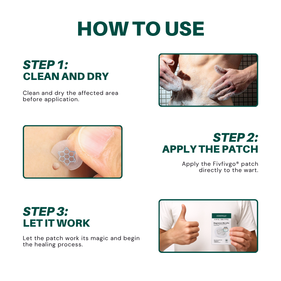 Fivfivgo® Magnesium MicroPin HPV Genital Wart Removal Patch Pro