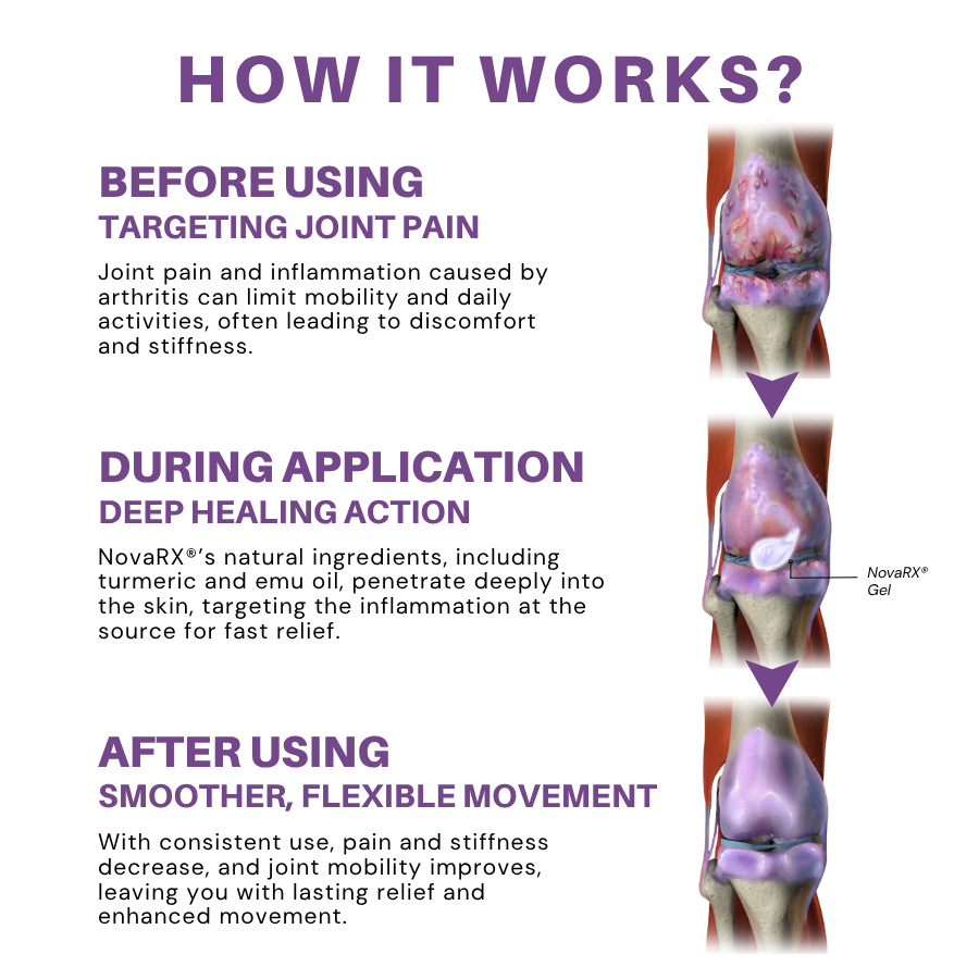 NovaRX® Turmeric & Emu Oil Arthritis Soothing Pain Relief Gel