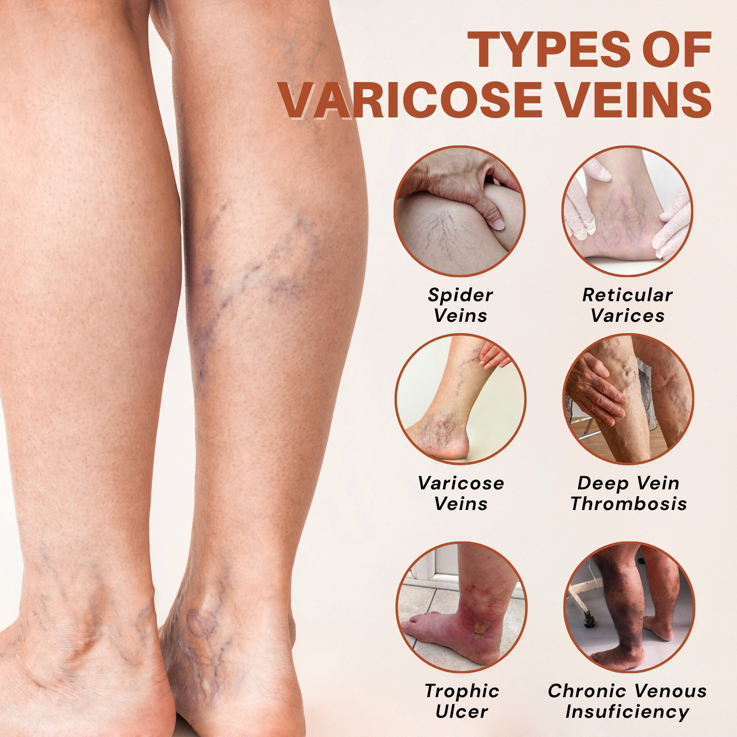 NovaRX® VeinTarget Nanotech Microneedle Patch