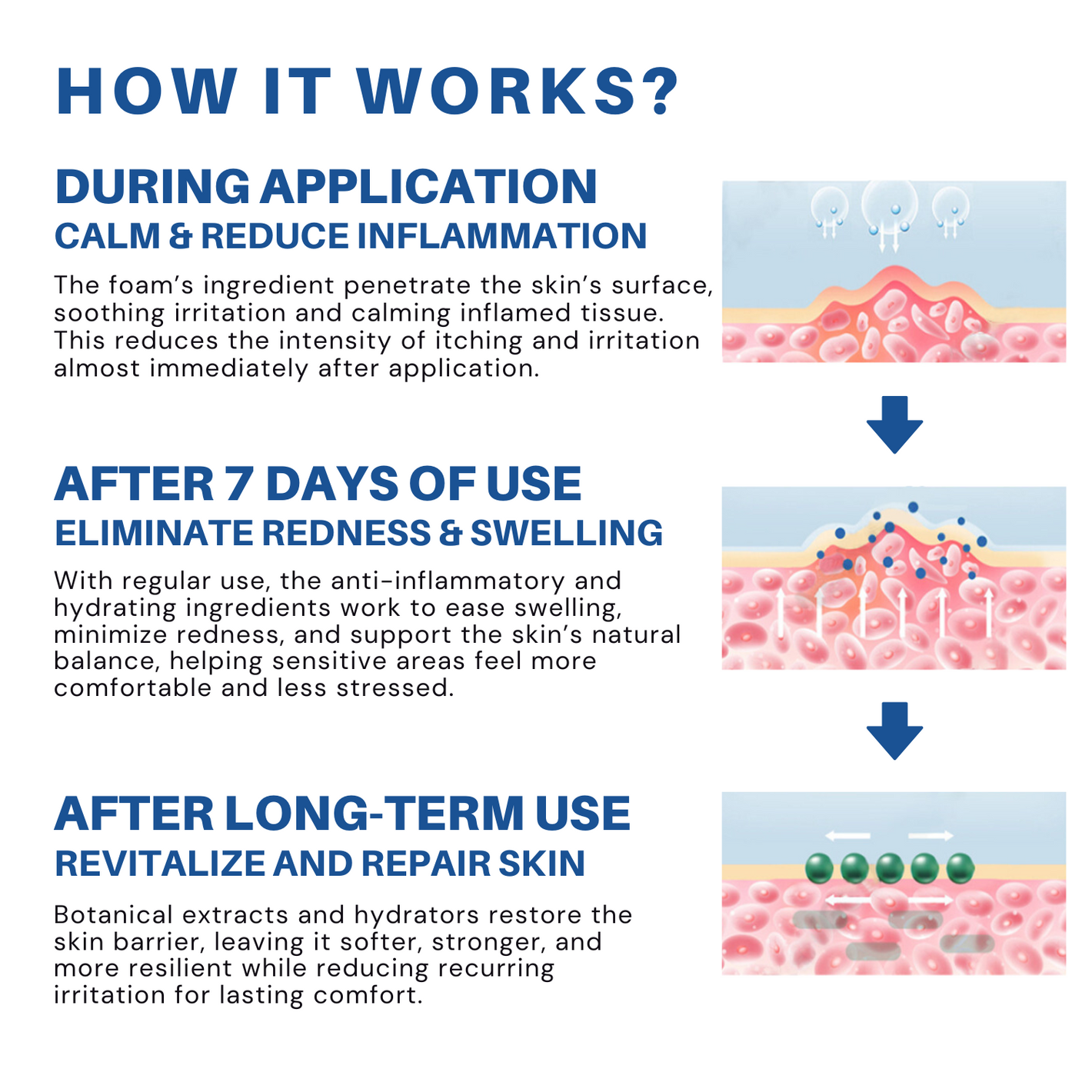 Fivfivgo® Advanced HPV & Rash Relief Genital Foam 18 Fivfivgo® Advanced HPV & Rash Relief Genital Foam