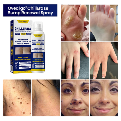 Oveallgo® ChillErase Bump Renewal Spray