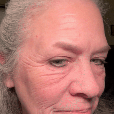 Oveallgo® Anti-Wrinkle Cream To Eliminate Wrinkles, Firm And Whiten The Skin - Last offer! 🔥90% discount