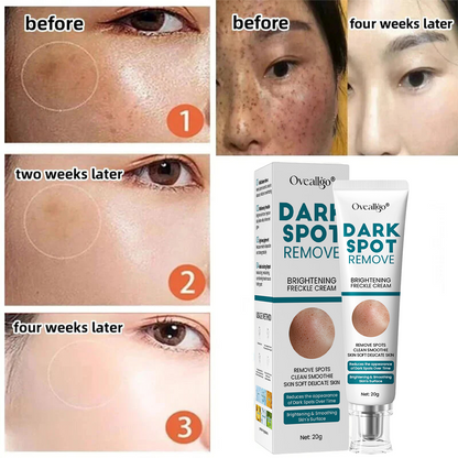 [Official Store] Oveallgo® Blemish Removing Beauty Cream – Fades Dark Spots, Freckles & Wrinkles | Age-Defying, Even-Tone Treatment