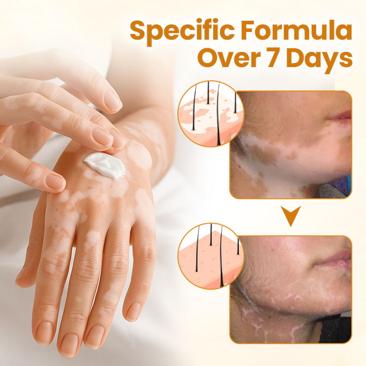 Oveallgo® Bee Venom Calm Cream PRO