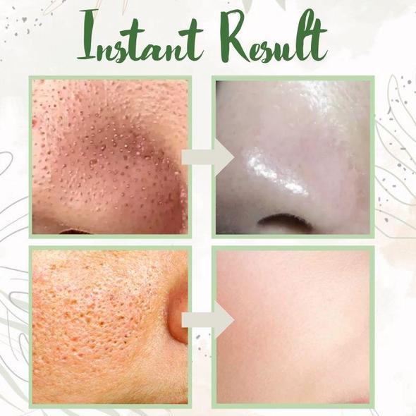 Final Sale - Oveallgo® Green Tea Deep Cleanse Mask - （Limited time discount 🔥 last day）