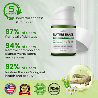✅ Official Store: Oveallgo™ NatureErase Instant Mole & Spot Cream
