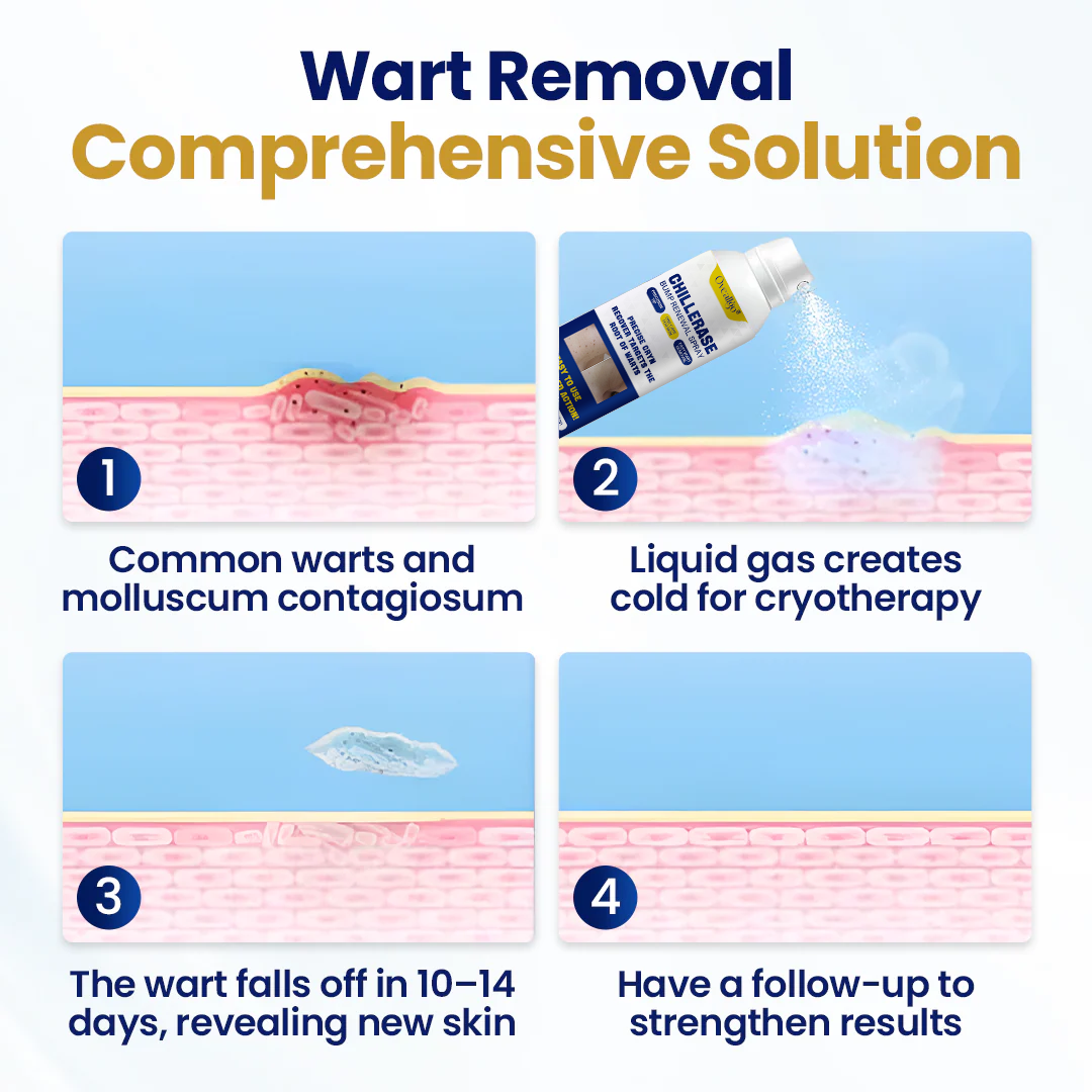 Oveallgo® ChillErase Bump Renewal Spray