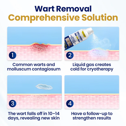 Oveallgo® ChillErase Bump Renewal Spray