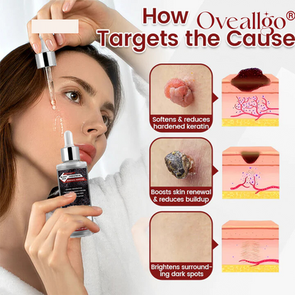 Oveallgo® KeraErase Black Rice Renewal Ampoule