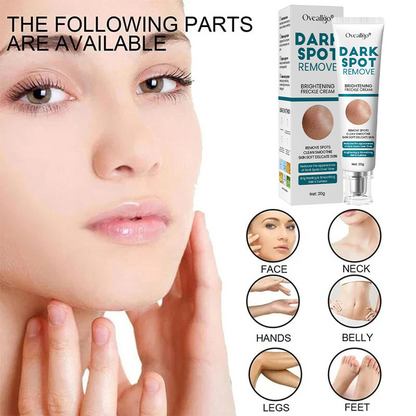 [Official Store] Oveallgo® Blemish Removing Beauty Cream – Fades Dark Spots, Freckles & Wrinkles | Age-Defying, Even-Tone Treatment