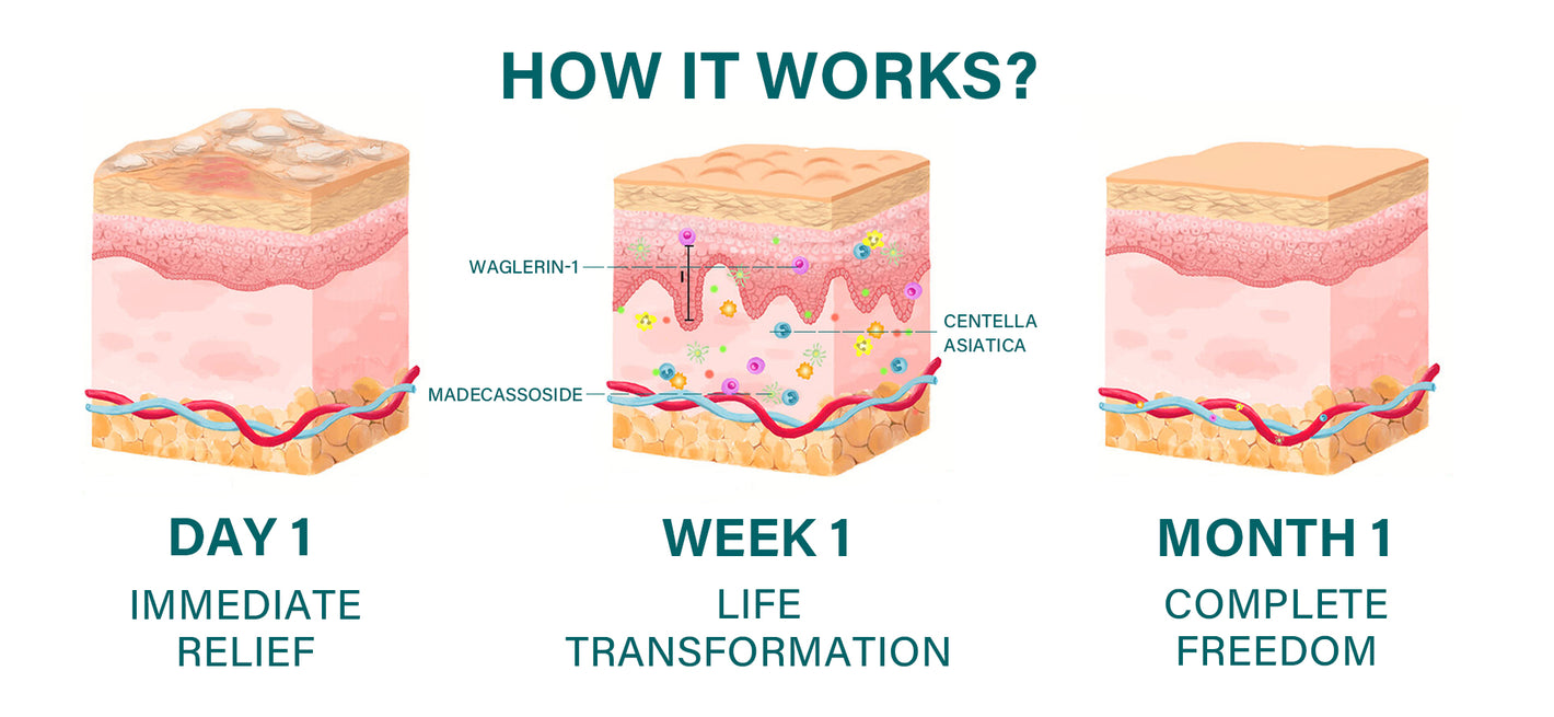 Oveallgo® Shingles Calm Snake Peptide Ampoules 15 Oveallgo® Shingles Calm Snake Peptide Ampoules