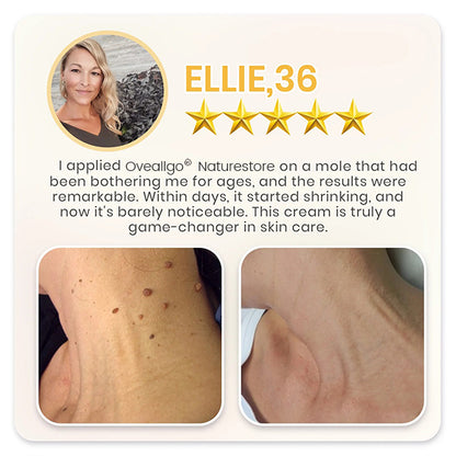 Oveallgo® NATURESTORE Instant Mole & Spot Cream