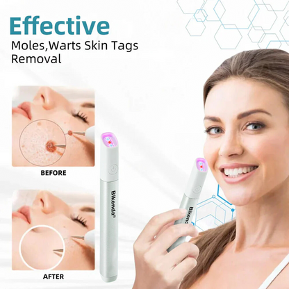 ✨Bikenda® All-in-One CO₂ Laser Eraser Pen | Removes Moles, Warts, Skin Flaws & Pigmentation