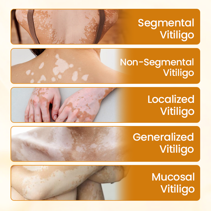 Oveallgo® Bee Venom Calm Cream PRO