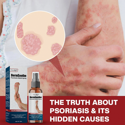 Oveallgo® DermSoothe Psoriasis Relief Spray
