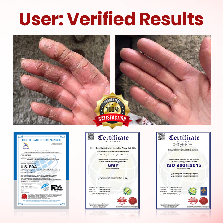 Oveallgo® VitaGluco Diabetic Care Cream