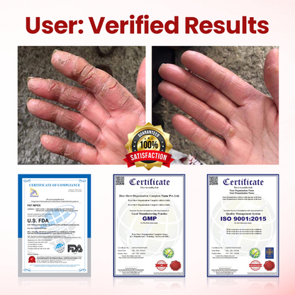 Oveallgo® VitaGluco Diabetic Care Cream