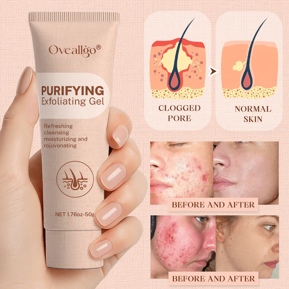 Oveallgo® Purifying Exfoliating Gel for Acanthosis Nigricans, Exfoliation, Dark Spots, Skin Tags, and Eczema_Ultra01