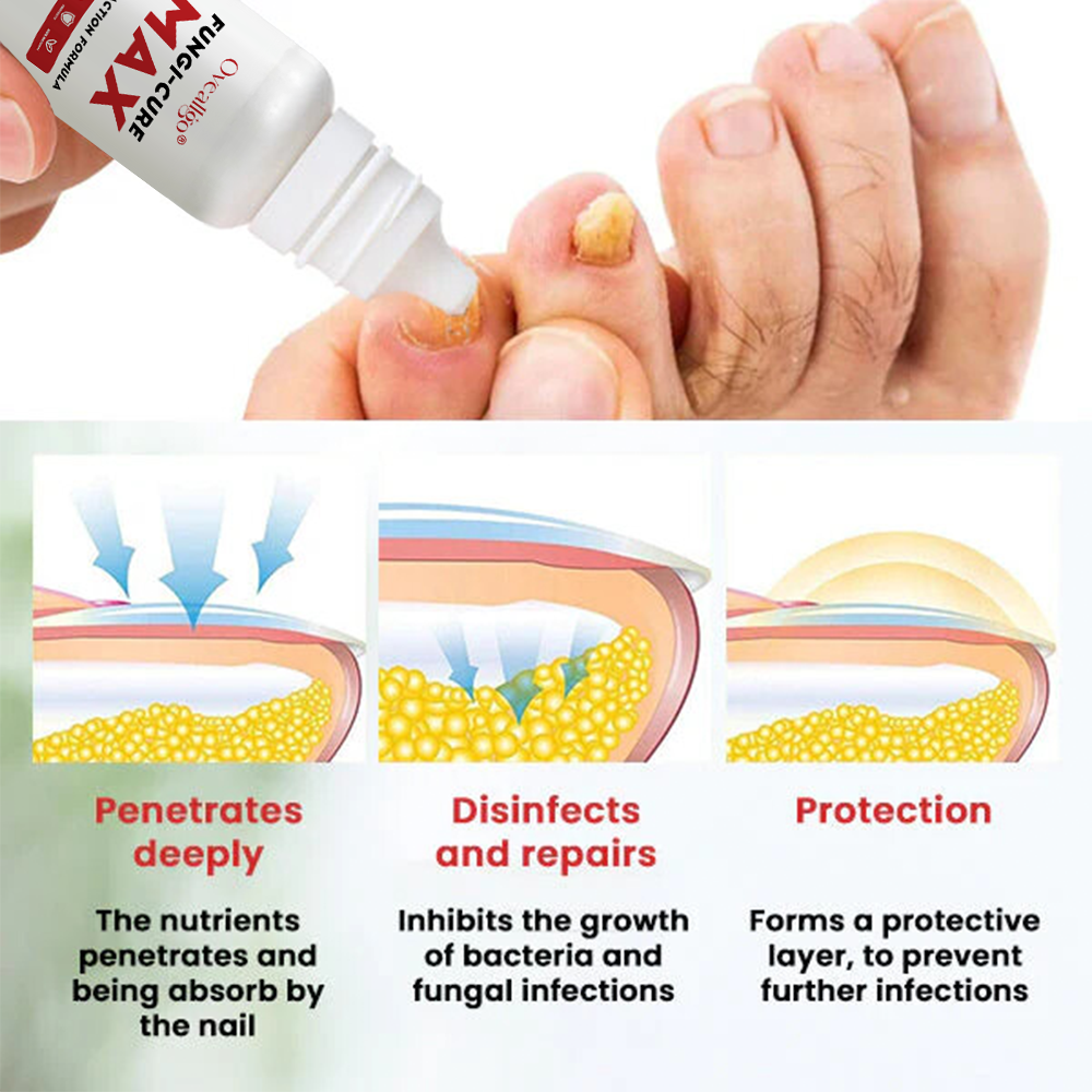 Oveallgo® Fungi-Cure Max