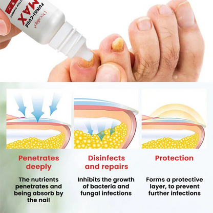 Oveallgo® Fungi-Cure Max