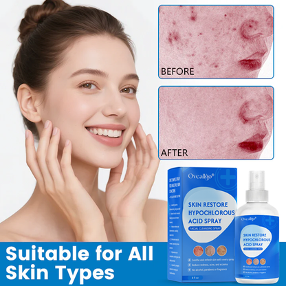 Oveallgo®  Skin Restore Hypochlorous Acid Spray