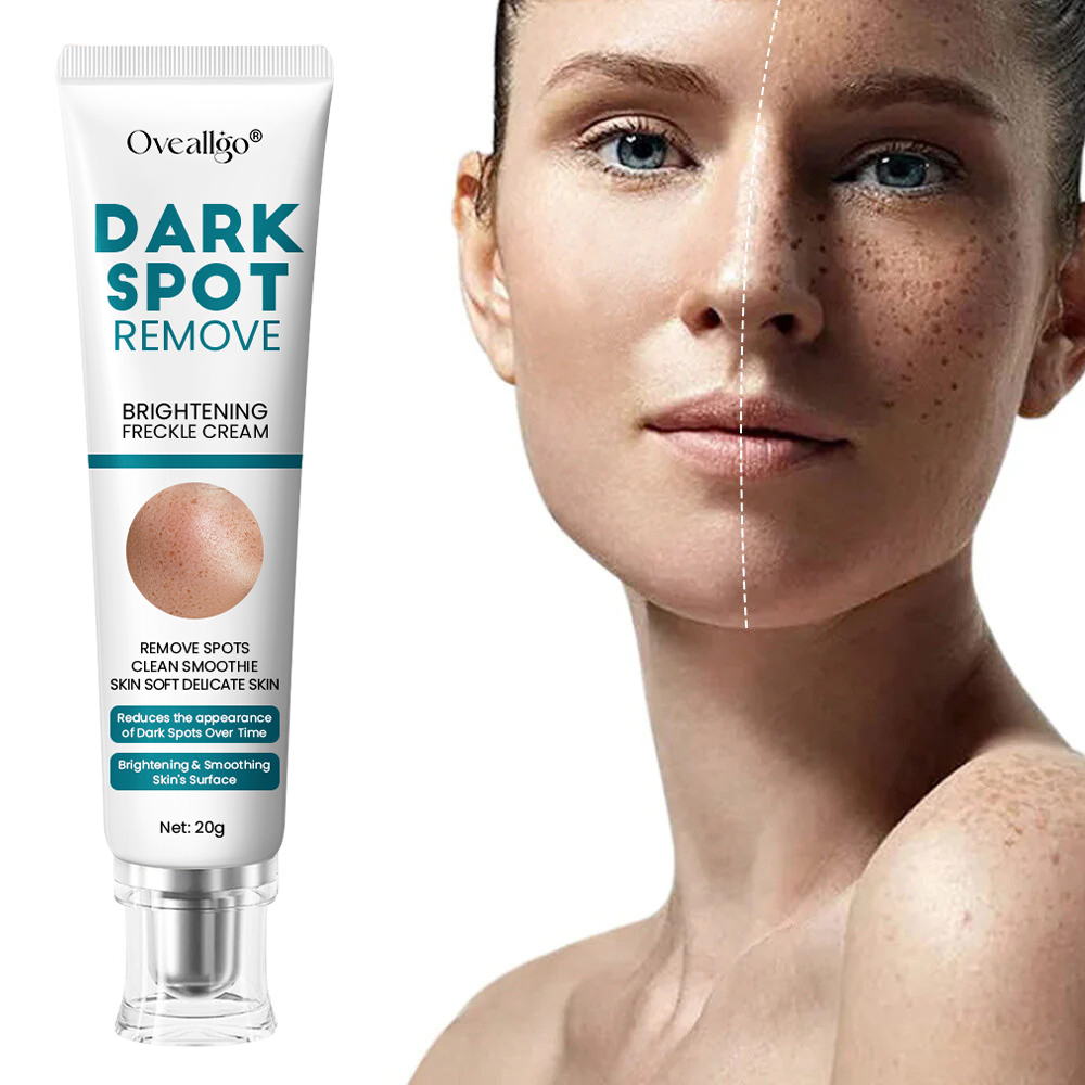 [Official Store] Oveallgo® Blemish Removing Beauty Cream – Fades Dark Spots, Freckles & Wrinkles | Age-Defying, Even-Tone Treatment
