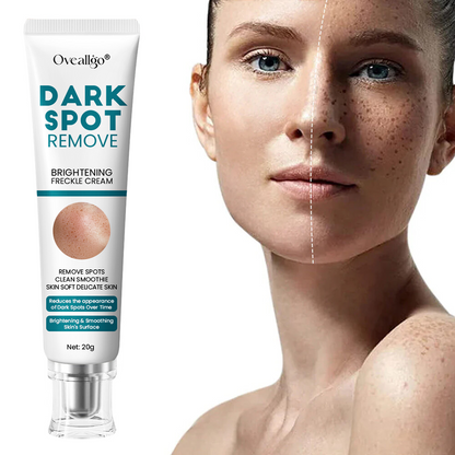 [Official Store] Oveallgo® Blemish Removing Beauty Cream – Fades Dark Spots, Freckles & Wrinkles | Age-Defying, Even-Tone Treatment