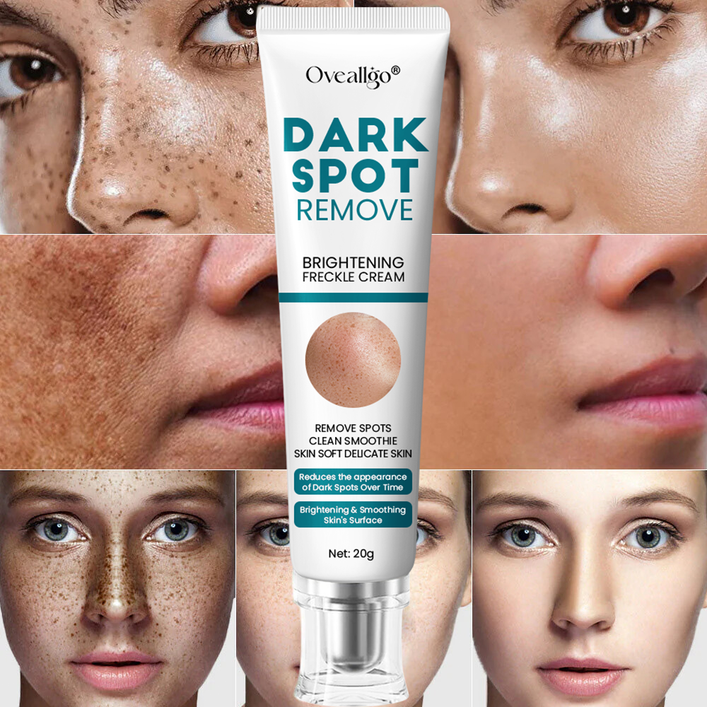 [Official Store] Oveallgo® Blemish Removing Beauty Cream – Fades Dark Spots, Freckles & Wrinkles | Age-Defying, Even-Tone Treatment