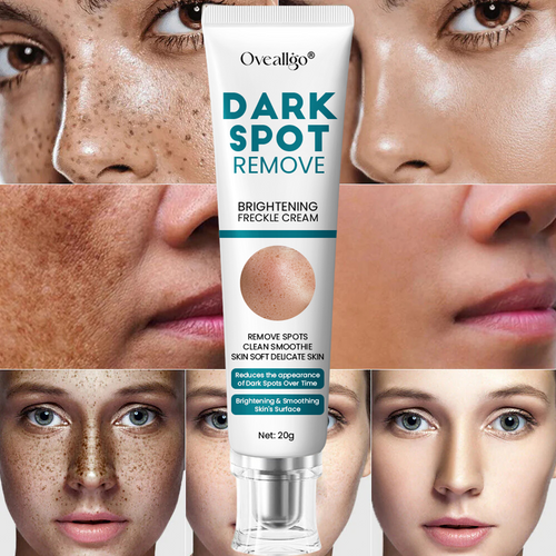 [Official Store] Oveallgo® Blemish Removing Beauty Cream – Fades Dark Spots, Freckles & Wrinkles | Age-Defying, Even-Tone Treatment