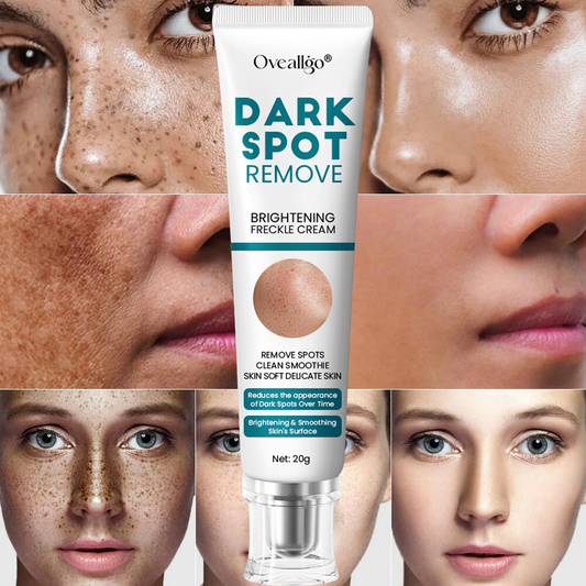 [Official Store] Oveallgo® Blemish Removing Beauty Cream – Fades Dark Spots, Freckles & Wrinkles | Age-Defying, Even-Tone Treatment