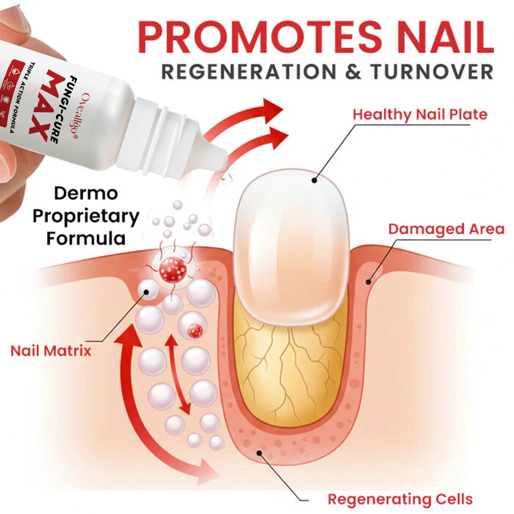 Oveallgo® Fungi-Cure Max