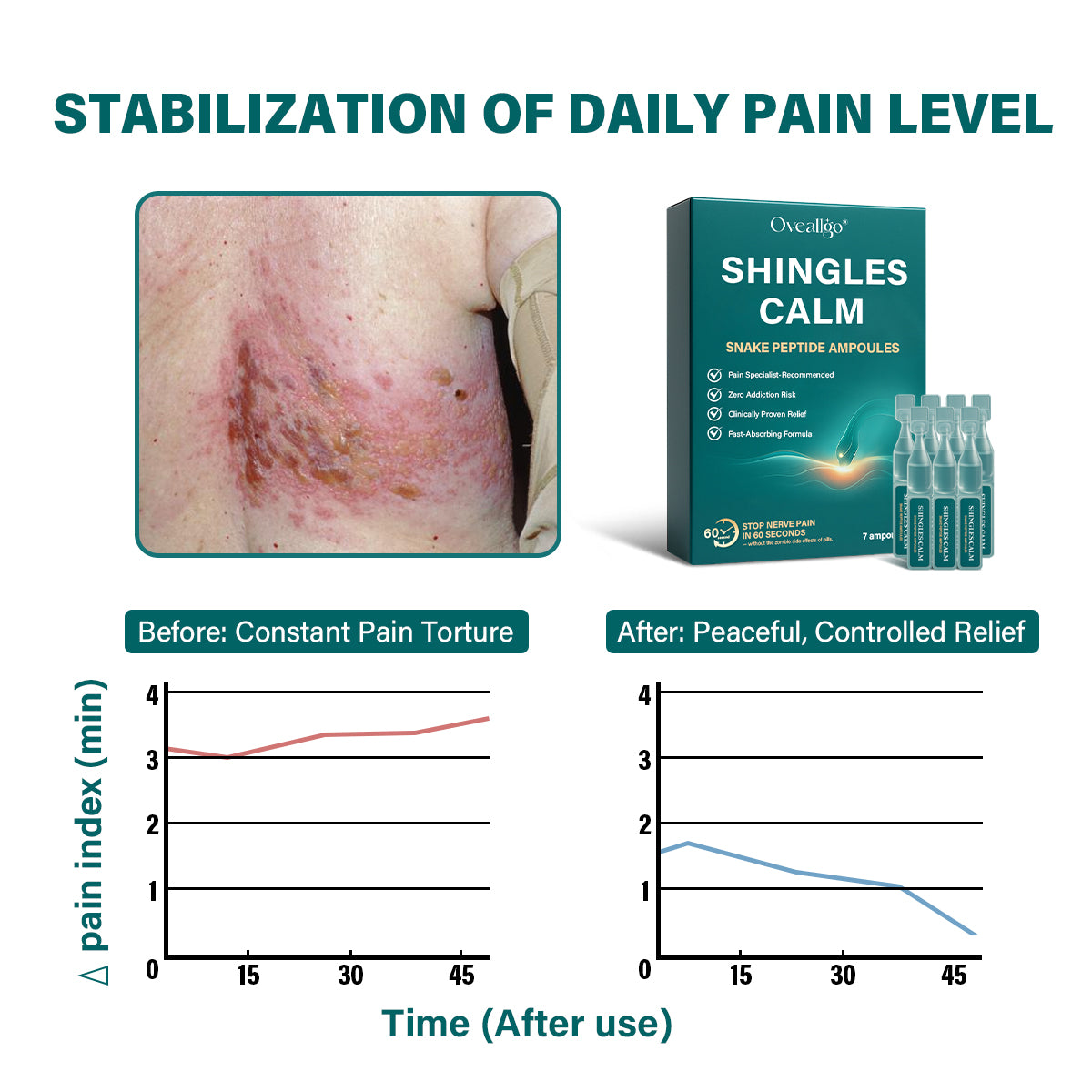 Oveallgo® Shingles Calm Snake Peptide Ampoules 19 Oveallgo® Shingles Calm Snake Peptide Ampoules