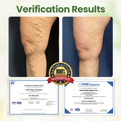 Oveallgo® Lymphatic Detox Herbal Cream